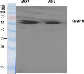 Cytokeratin 8 Polyclonal Antib