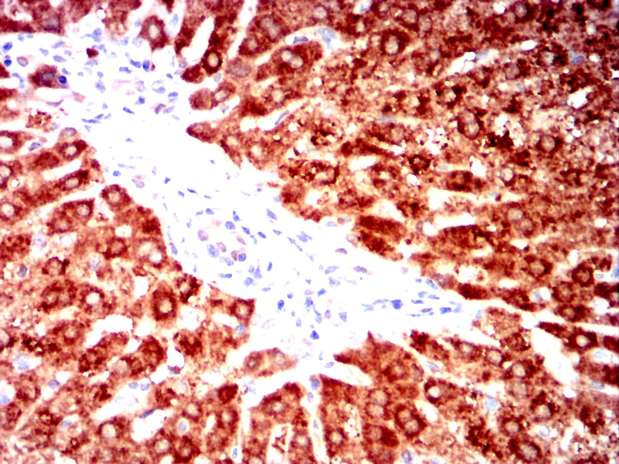 AKR1C1 Mouse mAb[63040]