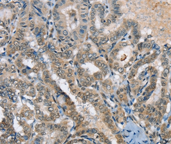 SEPN1 Antibody[37905]