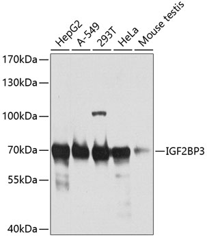 IGF2BP3 Rabbit Polyclonal Anti