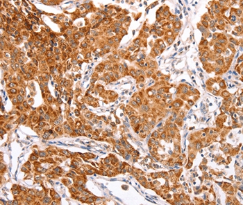 TRAF5 Antibody[35971]
