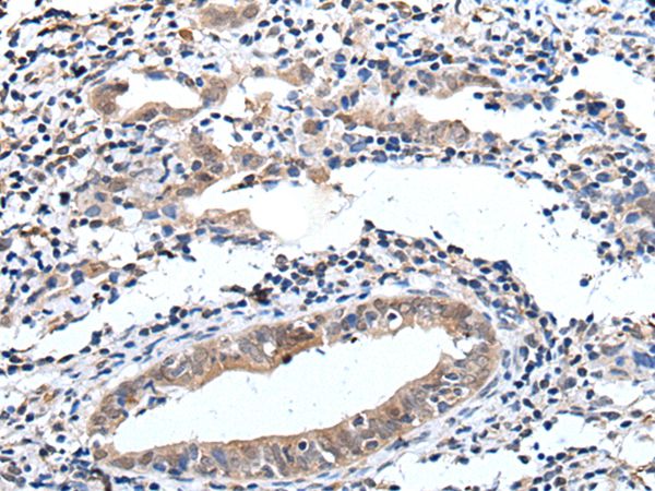 ELMO1 Antibody[43515]