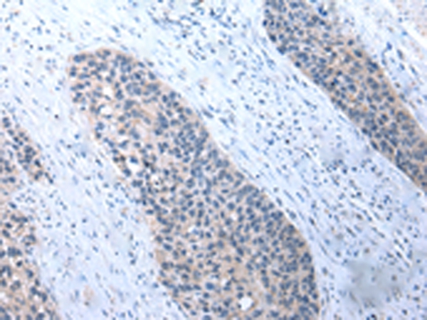 UMPS Antibody[43030]