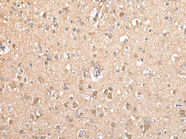 TYROBP Antibody[42901]