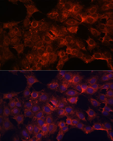 PDP2 Rabbit Polyclonal Antibod