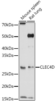 CLEC4D antibody[38441]