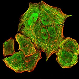 HLA-B Mouse mAb[63731]