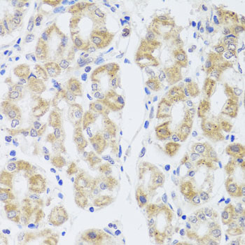 AQP0 antibody[38479]