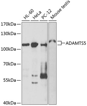 ADAMTS5 Rabbit Polyclonal Anti