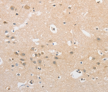 APLF Antibody[36118]