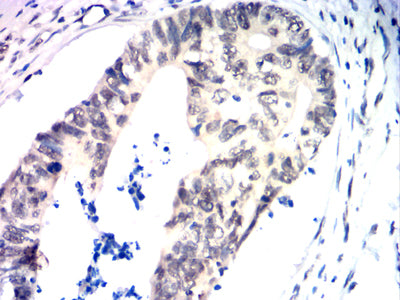 TDP43 Mouse mAb[64305]