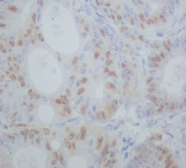 Cyclin A1/A2 Rabbit mAb[56107]