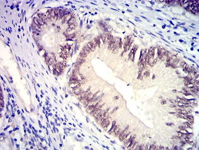 SATB2 Mouse mAb[64210]