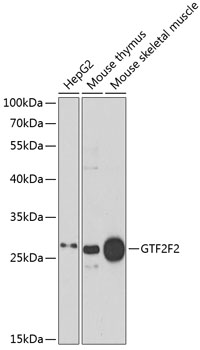 GTF2F2 Rabbit Polyclonal Antib