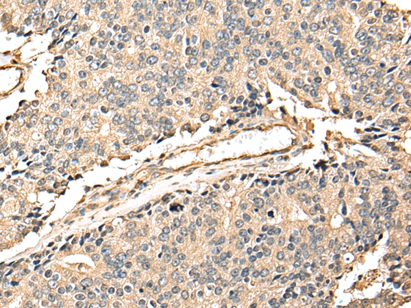 EEF1E1 Antibody[42964]