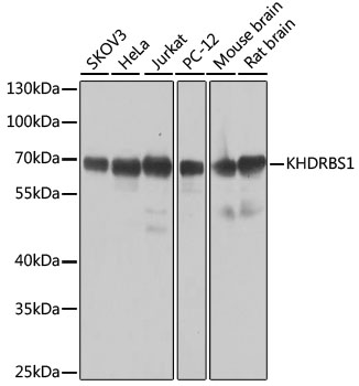 KHDRBS1 Rabbit Polyclonal Anti