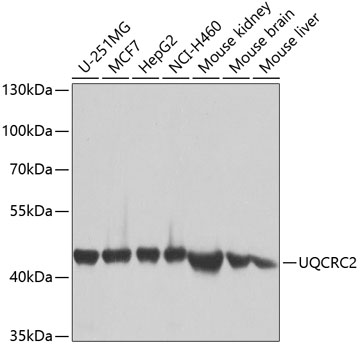 UQCRC2 Rabbit Polyclonal Antib