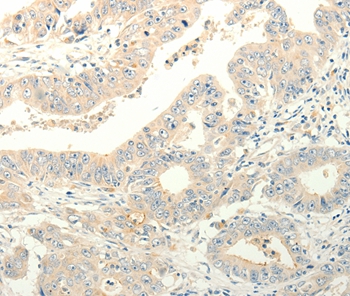 TPH1 Antibody[35965]
