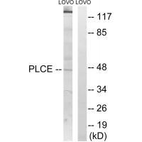 AGPAT5 Antibody[34304]