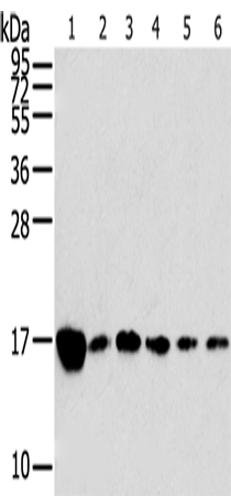 RPLP2 Antibody[42743]