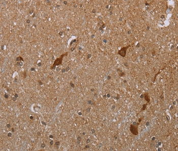 CASP8AP2 Antibody[37574]