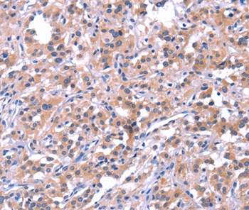 EP300 Antibody[37550]