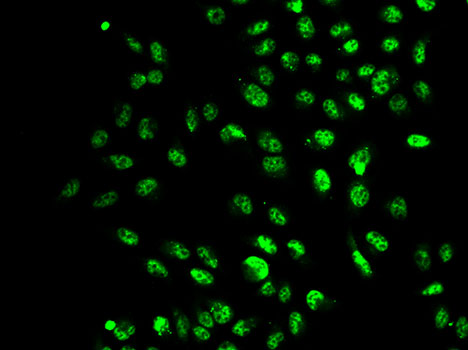 SETD2 antibody[38633]