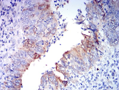 GRIA2 Mouse mAb[63689]