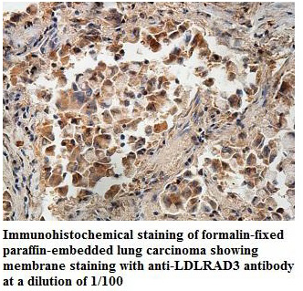 LDLRAD3 Antibody[39887]