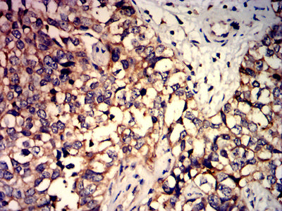 C5AR2 Mouse mAb[63179]