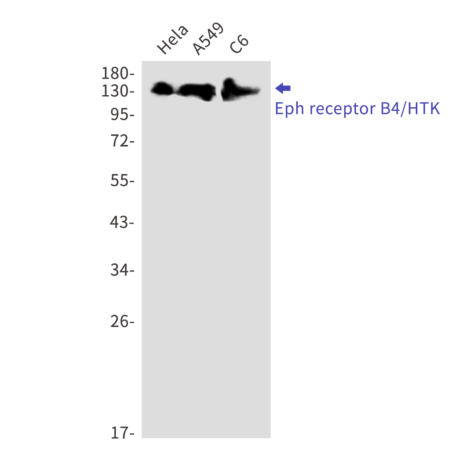 Ephrin Receptor B4 Rabbit mAb[