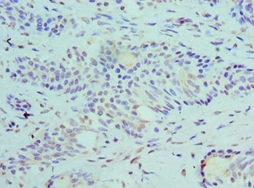 SLURP1 Polyclonal Antibody[423