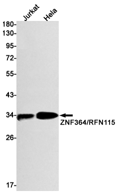 ZNF364 Rabbit mAb[52012]
