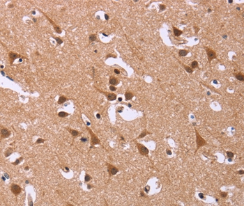 DCBLD2 Antibody[36401]