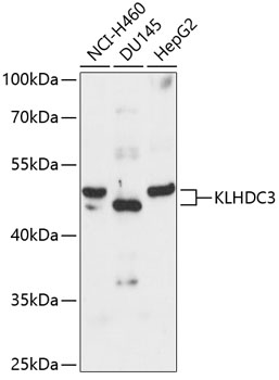 KLHDC3 Rabbit Polyclonal Antib