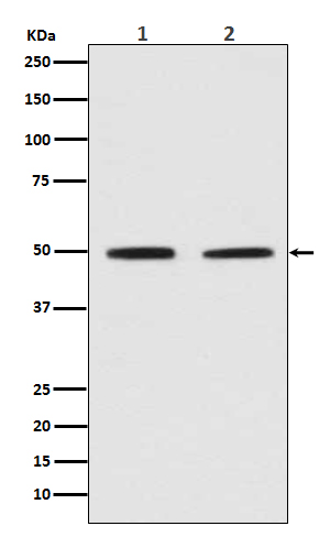 Pygopus 2 Rabbit mAb[56011]