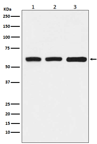 KAT9 / Elp3 Rabbit mAb[56261]