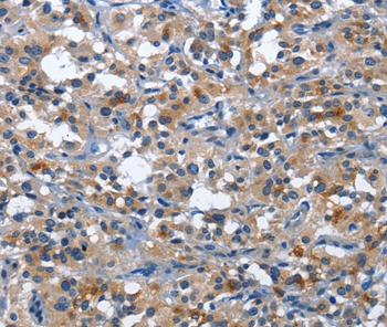 CD177 Antibody[36325]