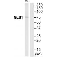 GLB1 Antibody[34494]