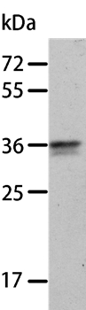 ANXA8 Antibody[35621]