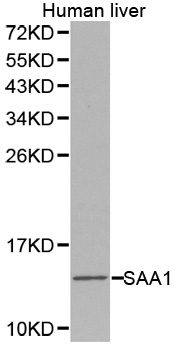 SAA1 antibody[38275]