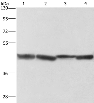 ADH1A Antibody[36075]