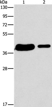 SAE1 Antibody[36160]