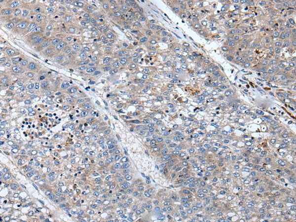 BICD1 Antibody[43846]