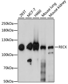 RECK Rabbit Polyclonal Antibod