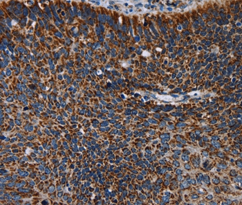 IDH2 Antibody[36544]