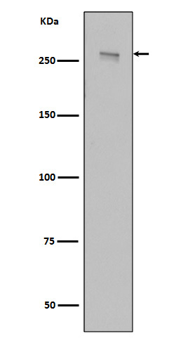 LRRK2 Rabbit mAb[56031]