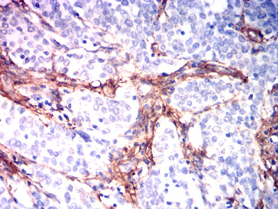 ITGA1 Mouse mAb[63794]