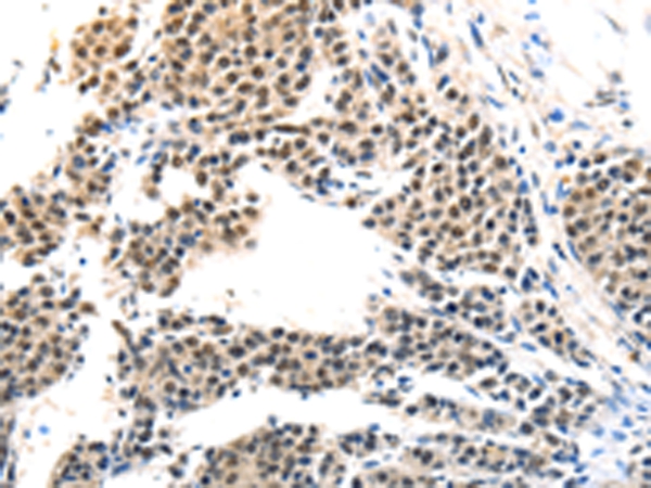 MAGEA6 Antibody[43096]