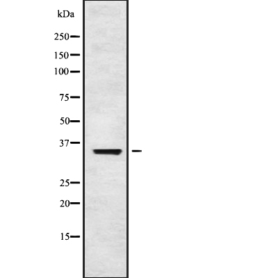 OR5L1/2 Antibody[44613]
